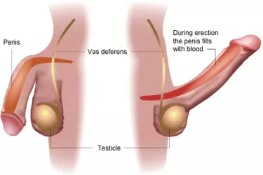 best doctor for the treatment of ED in india, best hospital for the treatment of ED, non surgical treatment for ED, surgery for erectile dysfunction in india